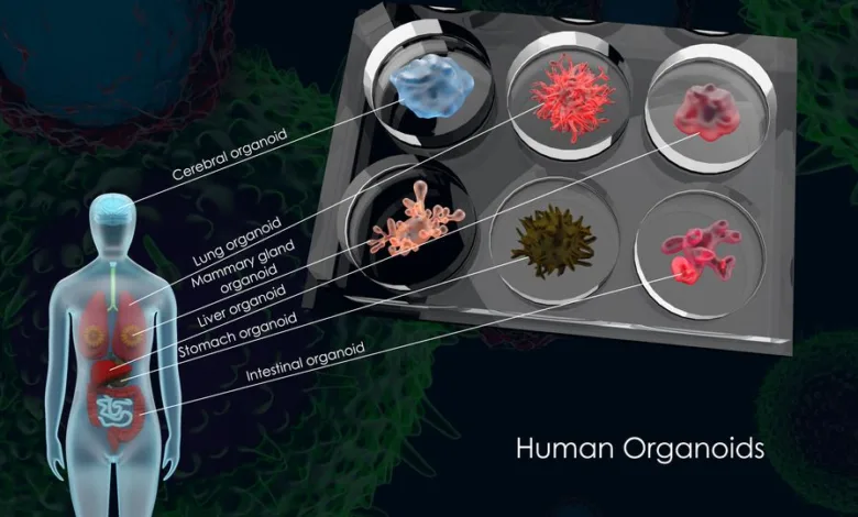 Organoid Breakthroughs: New Avenues for Pancreatic Cancer Treatment