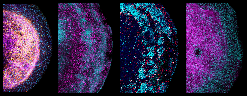 Neurological Revolution: Unveiling the Secrets of Mini-Brains from Fetal Tissue"