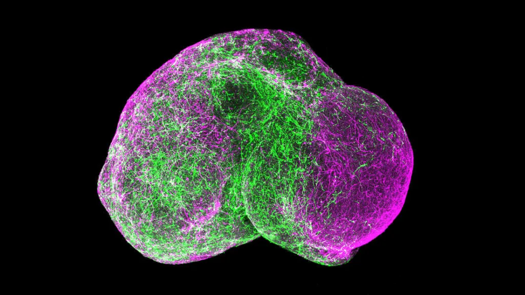 Neurological Revolution: Unveiling the Secrets of Mini-Brains from Fetal Tissue"